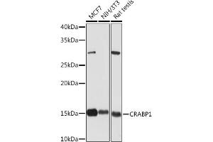 Western blot analysis of extracts of various cell lines, using CR Rabbit mAb (ABIN7266269) at 1:1000 dilution. (CRABP1 antibody)