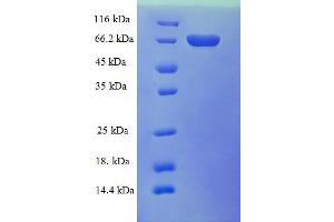 SDS-PAGE (SDS) image for Alcohol Dehydrogenase 5 (Class III), chi Polypeptide (ADH5) (AA 2-374) protein (GST tag) (ABIN5709001) (ADH5 Protein (AA 2-374) (GST tag))