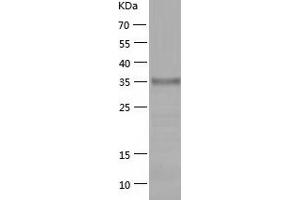 Western Blotting (WB) image for C-Type Lectin Domain Family 14, Member A (CLEC14A) (AA 22-398) protein (His tag) (ABIN7287784) (CLEC14A Protein (AA 22-398) (His tag))