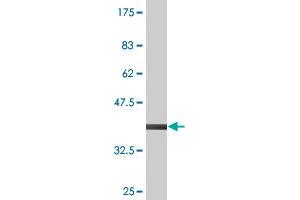 Western Blot detection against Immunogen (37. (PDIA4 antibody  (AA 355-464))