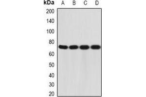 Western blot analysis of CD212 expression in A431 (A), MCF7 (B), mouse liver (C), mouse thymus (D) whole cell lysates. (IL12RB1 antibody)