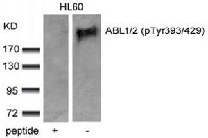 Image no. 3 for anti-Abelson Murine Leukemia Viral Oncogene Homolog 1/2 (ABL1/ABL2) (pTyr393), (pTyr439) antibody (ABIN319285) (ABL1/2 antibody  (pTyr393, pTyr439))