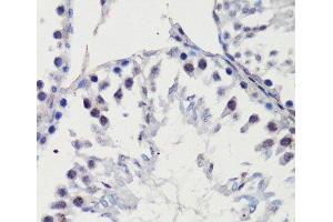 Immunohistochemistry of paraffin-embedded Rat testis using p27 KIP 1 Polyclonal Antibody at dilution of 1:100 (40x lens). (CDKN1B antibody)