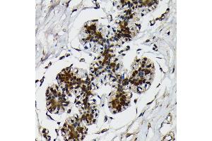 Immunohistochemistry of paraffin-embedded human breast using Ubiquitin antibody (ABIN7271129) at dilution of 1:100 (40x lens). (Ubiquitin B antibody)