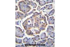 BTBD17 Antibody (C-term) immunohistochemistry analysis in formalin fixed and paraffin embedded human pancreas tissue followed by peroxidase conjugation of the secondary antibody and DAB staining. (BTBD17 antibody  (C-Term))