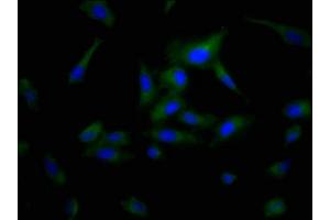 Immunofluorescence staining of Hela cells with ABIN7163899 at 1:200, counter-stained with DAPI. (POPDC3 antibody  (AA 130-291))