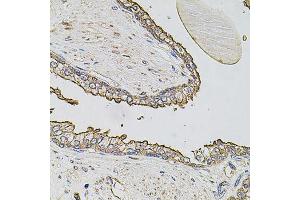 Immunohistochemistry of paraffin-embedded human prostate using ABCC3 antibody (ABIN6003581) at dilution of 1/100 (40x lens). (ABCC3 antibody)