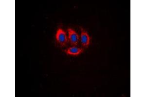 Immunofluorescent analysis of BMX (pY566) staining in HeLa cells. (BMX antibody  (C-Term, pTyr566))