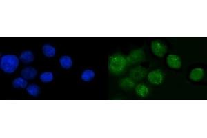 IF analysis of SP6 using anti-SP6 antibody (ABIN7599709).