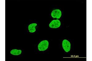 Immunofluorescence of monoclonal antibody to VPS8 on HeLa cell.