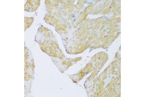 Immunohistochemistry of paraffin-embedded rat heart using DENR antibody (ABIN6133498, ABIN6139534, ABIN6139535 and ABIN6217790) at dilution of 1:150 (40x lens). (Density Regulated Protein antibody  (AA 1-198))