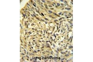 Immunohistochemistry (IHC) image for anti-FK506 Binding Protein 14, 22 KDa (FKBP14) antibody (ABIN3002691) (FKBP14 antibody)