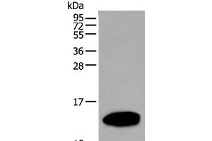 Western blot analysis of Human pancreas tissue lysate using REG1A Polyclonal Antibody at dilution of 1:500 (REG1A antibody)