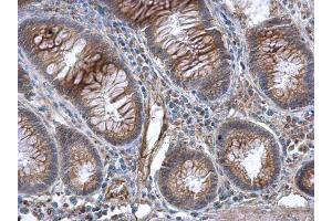 IHC-P Image GBP3 antibody [N1C1] detects GBP3 protein at cytoplasm in human colon by immunohistochemical analysis.