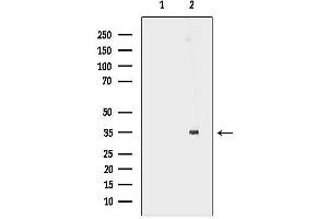 Western blot analysis of lysates from Mouse brain, using DOK5 Antibody.