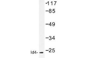 Image no. 1 for anti-Inhibitor of DNA Binding 4, Dominant Negative Helix-Loop-Helix Protein (ID4) antibody (ABIN317715) (ID4 antibody)