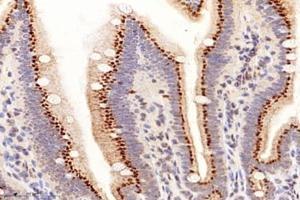Immunohistochemistry analysis of paraffin-embedded mouse small intestine using PRAP1 (ABIN7075198) at dilution of 1: 8000 (PRAP1 antibody)