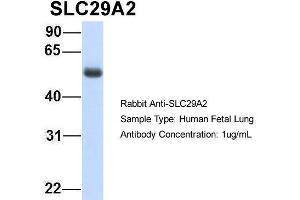 Host: Rabbit Target Name: SLC29A2 Sample Type: Human Fetal Lung Antibody Dilution: 1. (SLC29A2 antibody  (C-Term))