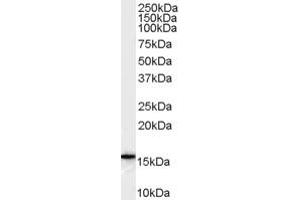 Western Blotting (WB) image for anti-DKFZp686P1551 (C-Term) antibody (ABIN2785710) (DKFZp686P1551 (C-Term) antibody)