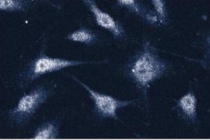 Immunofluorescence staining of human endothelial cells. (Annexin VII antibody  (AA 34-159))
