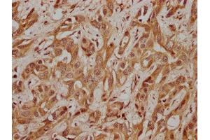 IHC image of ABIN7153705 diluted at 1:200 and staining in paraffin-embedded human ovarian tissue performed on a Leica BondTM system. (WDR24 antibody  (AA 1-298))
