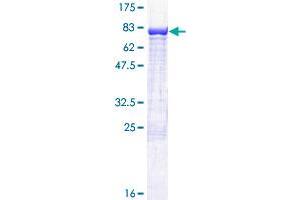 CDR2 Protein (AA 1-454) (GST tag)