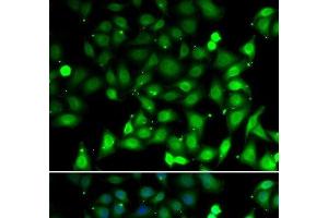Immunofluorescence analysis of MCF-7 cells using RAE1 Polyclonal Antibody (RAE1 antibody)