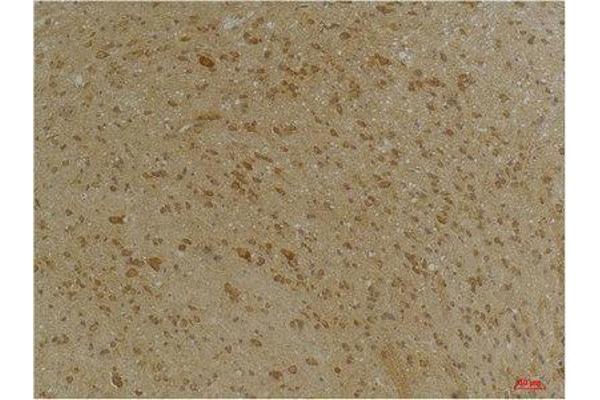 SLC12A4 antibody