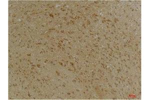 Immunohistochemistry (IHC) analysis of paraffin-embedded Mouse Brain Tissue using SLC12A4 Rabbit Polyclonal Antibody diluted at 1:200.