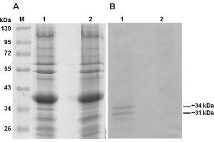 Western Blotting (WB) image for anti-COL1A2/COL1A1 antibody (ABIN5596819)