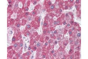 IHC testing of FFPE human liver tissue with ABCC5 antibody at 5ug/ml.