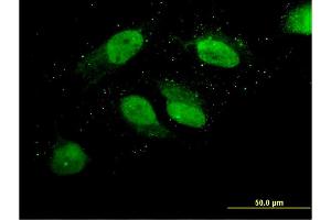 Immunofluorescence of monoclonal antibody to LOC220594 on HeLa cell. (LOC220594 (AA 255-354) antibody)