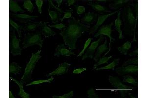 Immunofluorescence of monoclonal antibody to LETM1 on HeLa cell. (LETM1 antibody  (AA 601-708))