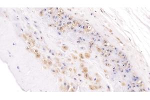 Detection of NOG in Human Placenta Tissue using Polyclonal Antibody to Noggin (NOG) (NOG antibody  (AA 28-232))