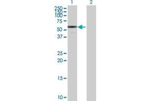 Western Blot analysis of ENTPD3 expression in transfected 293T cell line by ENTPD3 MaxPab polyclonal antibody. (ENTPD3 antibody  (AA 1-452))