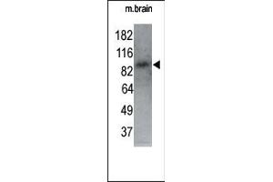 The anti-RK1 N-term Pab (ABIN391219 and ABIN2837964) is used in Western blot to detect RK1 in P7 mouse whole brain lysate (60 μg). (MARK1 antibody  (N-Term))