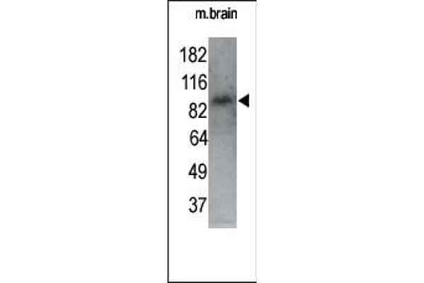 MARK1 antibody  (N-Term)