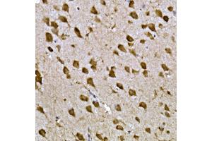 Immunohistochemistry of paraffin-embedded mouse brain using CPEB3 Rabbit pAb (ABIN7266666) at dilution of 1:300 (40x lens). (CPEB3 antibody  (AA 150-400))
