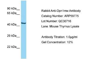 Western Blotting (WB) image for anti-Opsin 1 (Cone Pigments), Medium-Wave-Sensitive (OPN1MW) (C-Term) antibody (ABIN2788206) (OPN1MW antibody  (C-Term))