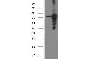 Western Blotting (WB) image for anti-Protein Kinase C, epsilon (PRKCE) antibody (ABIN1500235) (PKC epsilon antibody)