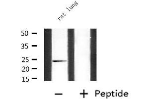 Western blot analysis of extracts from rat lung, using CDKN3 Antibody.