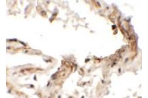 Immunohistochemical analysis of EMX2 in human lung tissue with EMX2 polyclonal antibody  at 2.