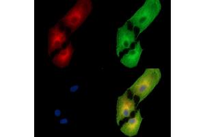 ABIN7095399 and ABIN7099456 staining  cells by IF/ICC. (C1orf114 antibody)