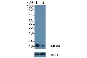 Western Blotting (WB) image for anti-S100 Calcium Binding Protein A6 (S100A6) (AA 1-90) antibody (ABIN7434041)