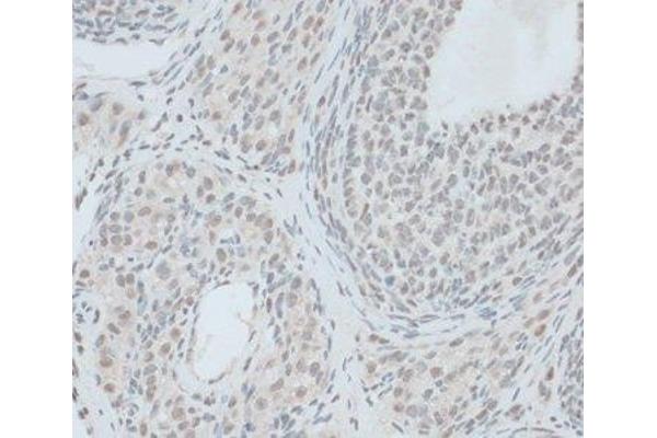 ZNF416 antibody