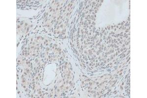 Immunohistochemistry of paraffin-embedded Rat ovary using ZNF416 Polyclonal Antibody at dilution of 1:100 (40x lens). (ZNF416 antibody)
