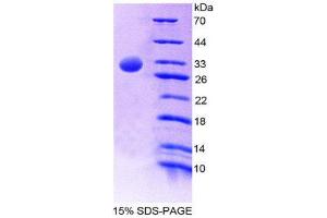 SDS-PAGE (SDS) image for General Transcription Factor IIH, Polypeptide 1, 62kDa (GTF2H1) (AA 84-335) protein (His tag) (ABIN2124949)
