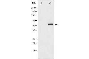 Western Blotting (WB) image for anti-Histone Deacetylase 1 (HDAC1) (pSer421) antibody (ABIN6255318)