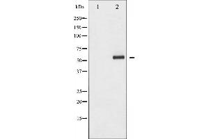 Western blot analysis of HDAC1 phosphorylation expression in EGF treated Jurkat whole cell lysates,The lane on the left is treated with the antigen-specific peptide. (HDAC1 antibody  (pSer421))