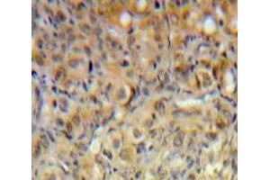 Used in DAB staining on fromalin fixed paraffin-embedded Ovary tissue (PIK3C2A antibody  (AA 172-403))